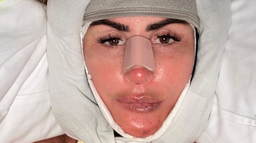 Rachel Uchitel zeigt sich nach zehnstündigem Facelift