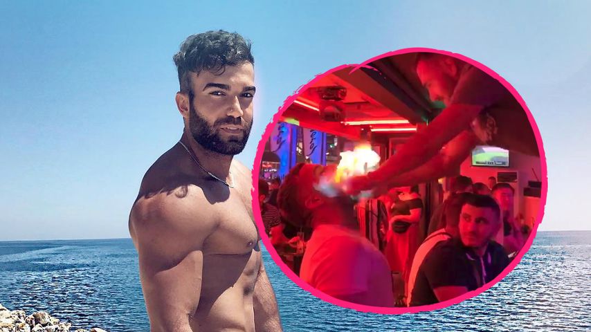 Feuer-Teufel: Rafi Rachek verbrennt sich Mund beim Saufen!