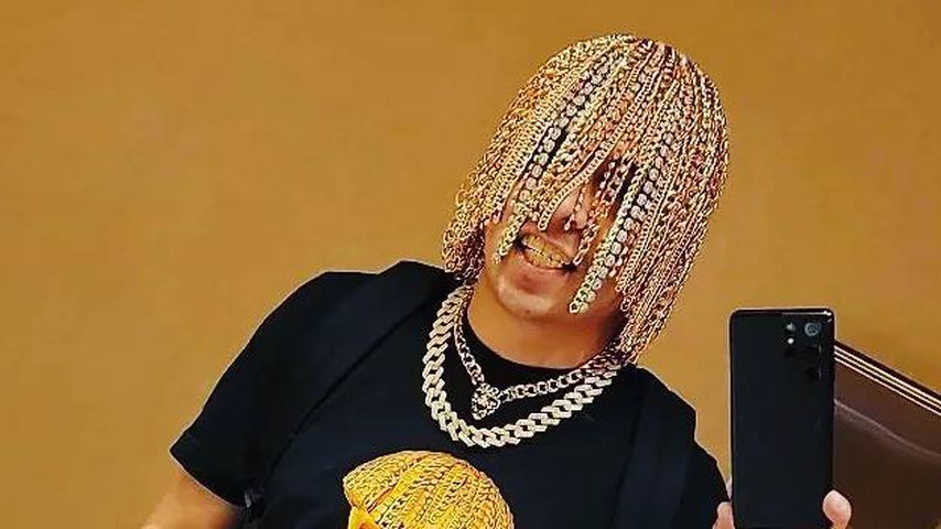 Irre! Rapper lässt sich Goldketten in Kopfhaut implantieren