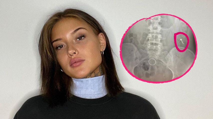 Wegen Piercing: "Are You The One?"-Jill Lange im Krankenhaus