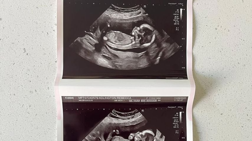 Rebecca Adlingtons postet das Ultraschallbild zur Schwangerschaft, 2025