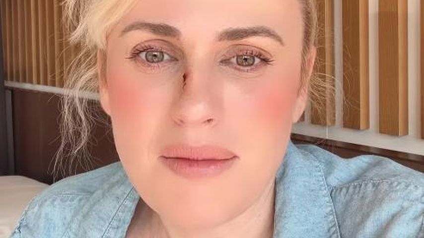 Neues Update: So geht es Rebel Wilson nach dem Set-Unfall!
