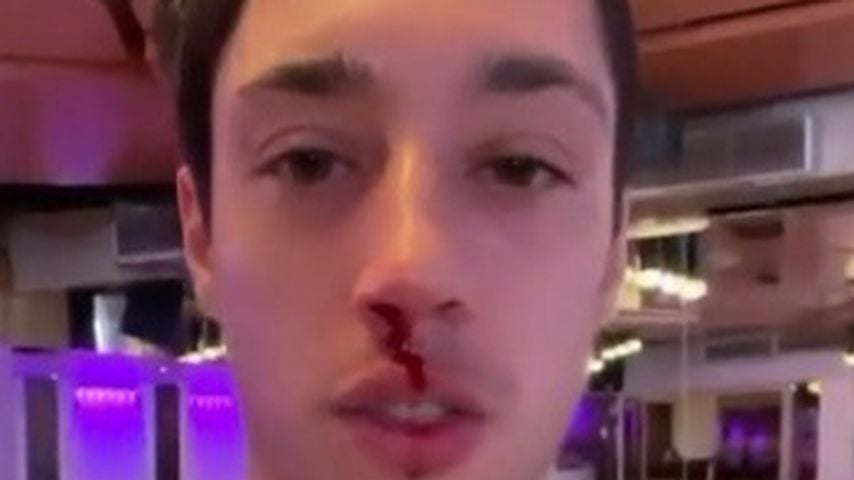 Zu wild? René Casselly blutet beim "Let's Dance"-Training!