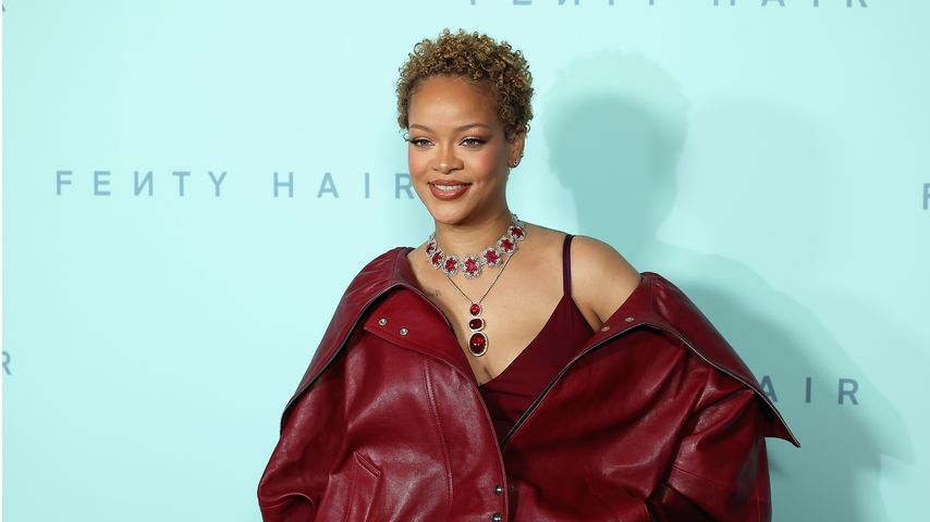 Rihanna hatte nach der Geburt ihrer Söhne enorm Haarausfall!
