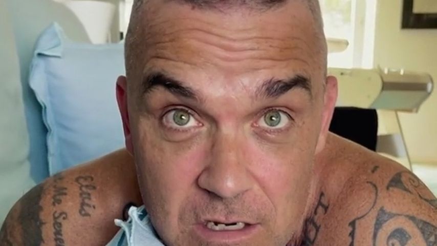 Lichtes Haar: Robbie Williams will auf Tour Perücke tragen