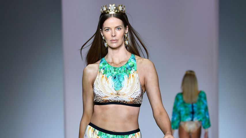 Blutiges Gesicht: Model Robyn Lawley stürzte Treppe hinunter