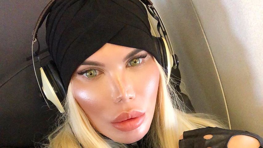 "Selbst Hormone verabreicht": Rodrigo Alves musste in Klinik