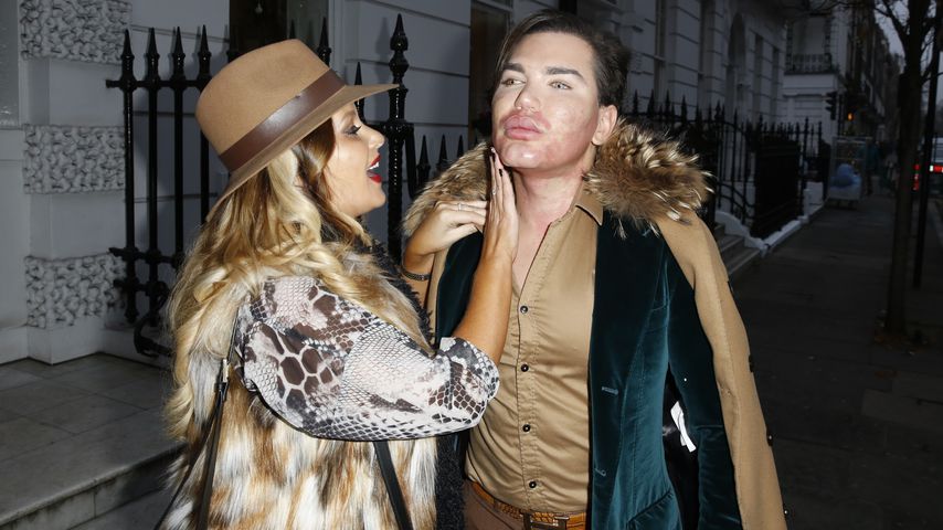 Risiko-OP wie bei Sophia: Real-Life-Ken entfernt 4 Rippen!