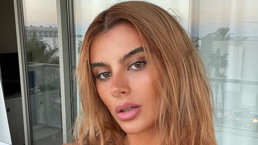 Ex-GNTM-Girl Romina Palm: "War abhängig von Abführmitteln"