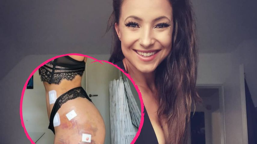 Vier Liter: "Ex on the Beach"-Roxy ließ sich Fett absaugen!