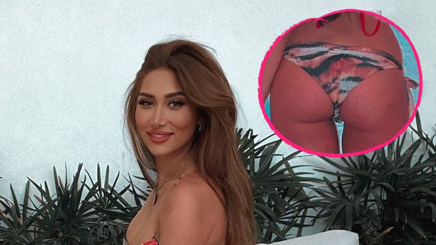 So sah "Bachelor in Paradise"-Samiras Po vor Beauty-OP aus!