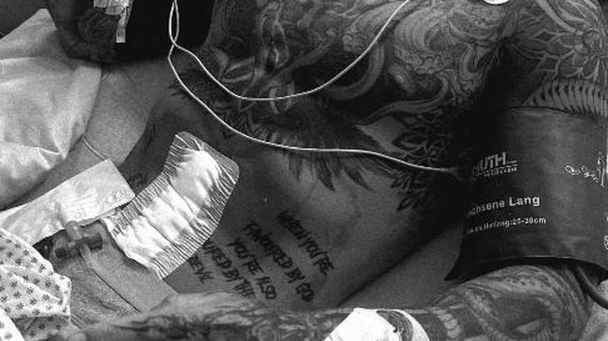 Samuel Dohmen nach seiner Not-OP, April 2026