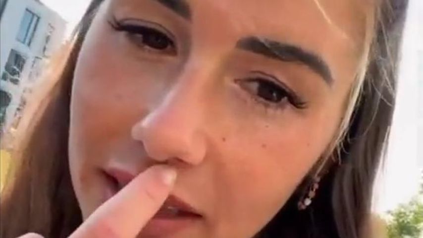 Sarah Engels leidet seit Schwangerschaft an Pigmentstörung