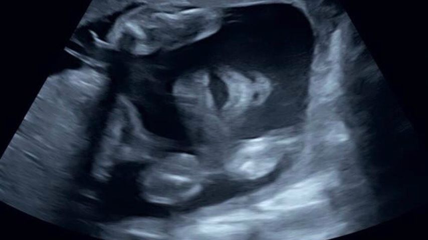 Sarah Joelle Jahnels Baby