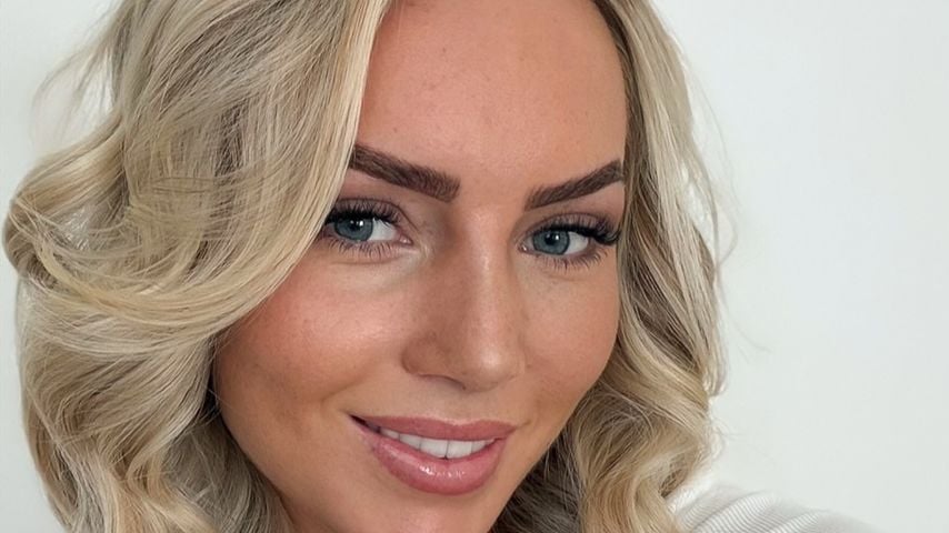 Dank Nasen-OP: Sarah Liebich liebt endlich ihr Seitenprofil