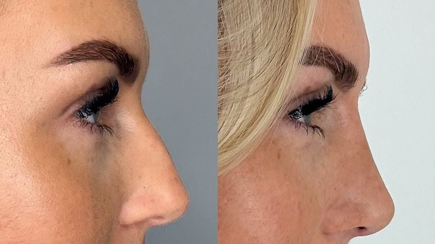 Vorher-Nachher-Vergleich von Sarah Liebich