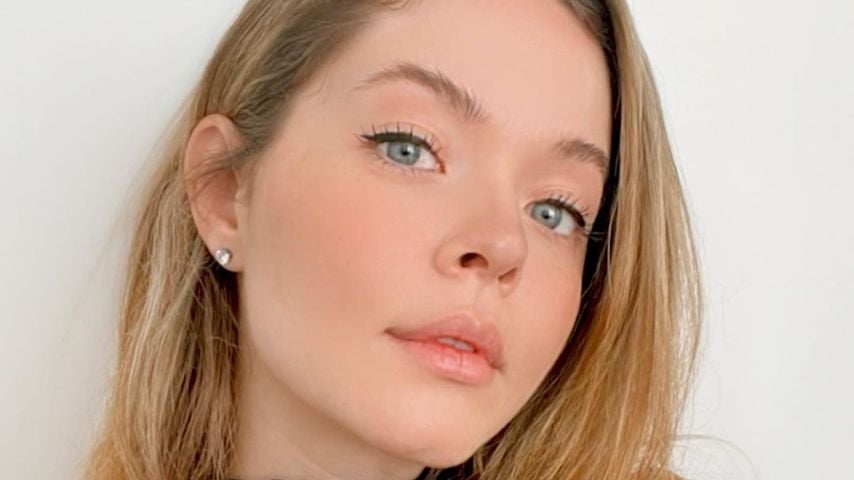 Wegen ihrer PCO-Erkrankung nahm Sasha Pieterse 31 Kilo zu
