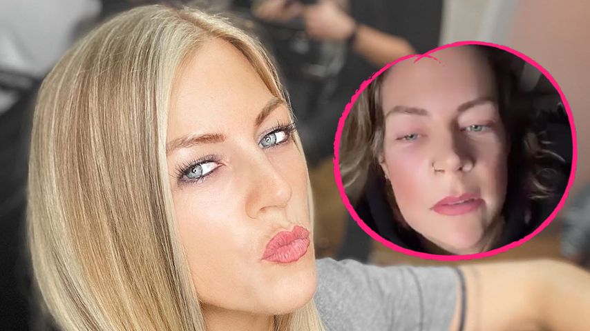 Total verformt: Was ist mit Saskia Beecks' Gesicht passiert?
