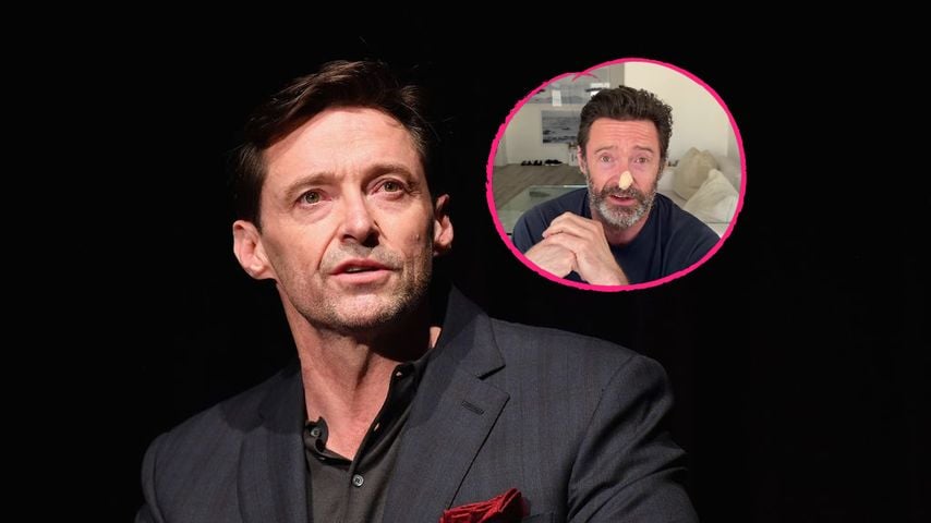 Erneuter Verdacht: Hat Hugh Jackman wieder Hautkrebs?