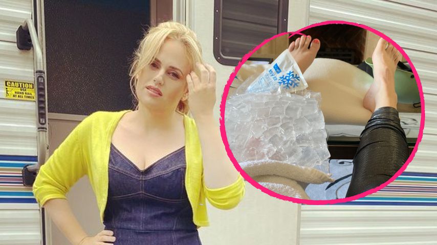 Hund rennt auf die Straße: Rebel Wilson hatte Fahrradunfall