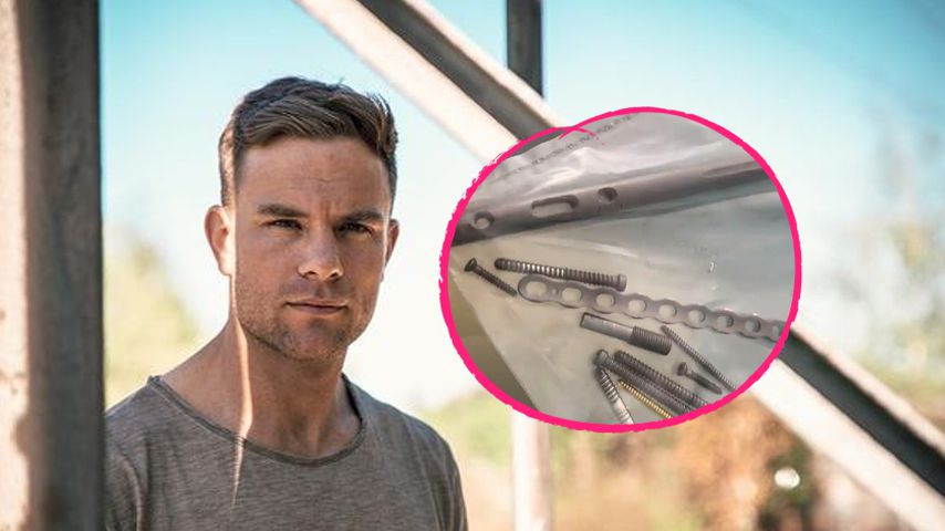Wegen Crash: Diese Metallstücke hatte Basti Preuss im Körper