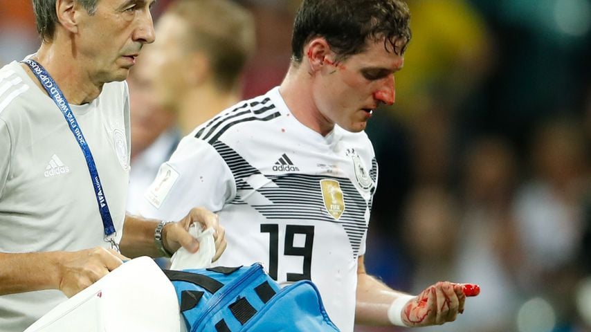 Tritt ins Gesicht: Sebastian Rudy muss blutend vom WM-Rasen!