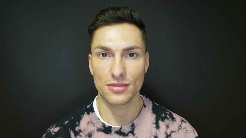 Sebastian von Kempin nach seiner Kinnunterspritzung
