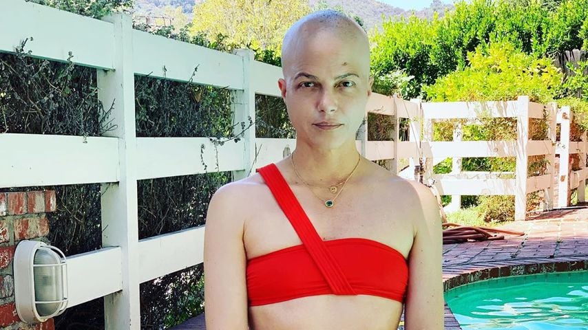 Haarausfall nach Chemo: Wie geht es Selma Blair damit?
