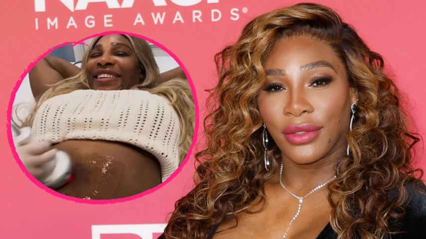 Wegen After-Baby-Body: Serena Williams lernt Selbstfürsorge!