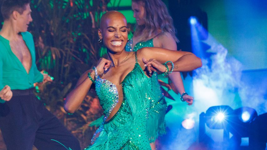 Hate-Kommentare wegen Glatze: "Let's Dance"-Sharon reagiert