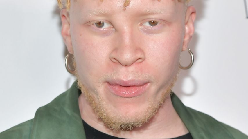 Grusel-Style! So rockt Albino-Model Shaun Ross das Coachella