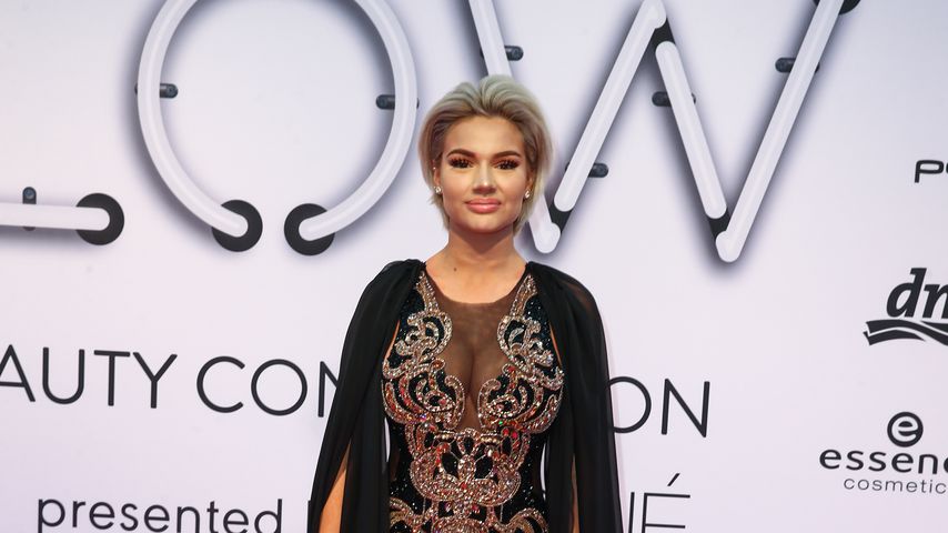 Einfach natürlicher: Shirin David kriegt neue Beißerchen!