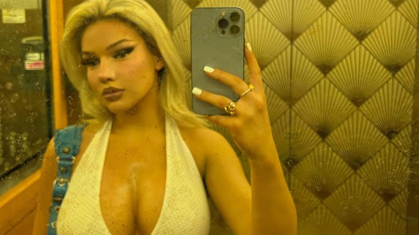 Shirin David plaudert aus: Sie hatte wieder eine Brust-OP!