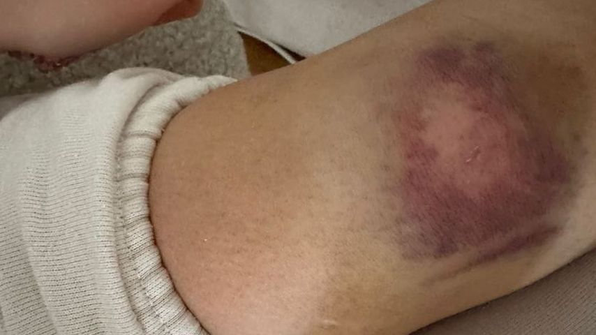 Shirin Davids Knie