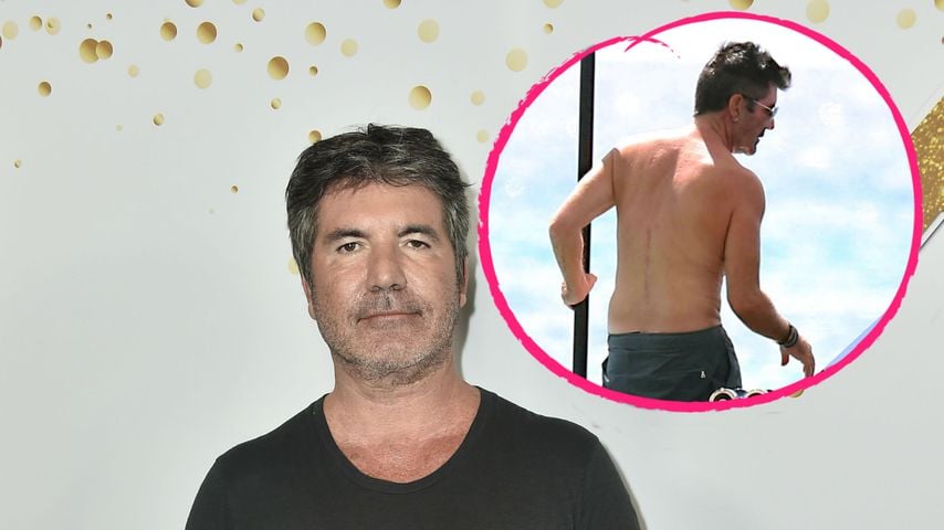 Fahrradunfall: Simon Cowell hat eine große Narbe am Rücken
