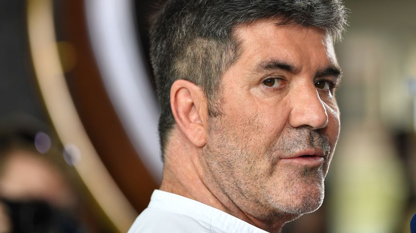 "X Factor"-Juror Simon Cowell: Er hatte Gesichtsstraffung!