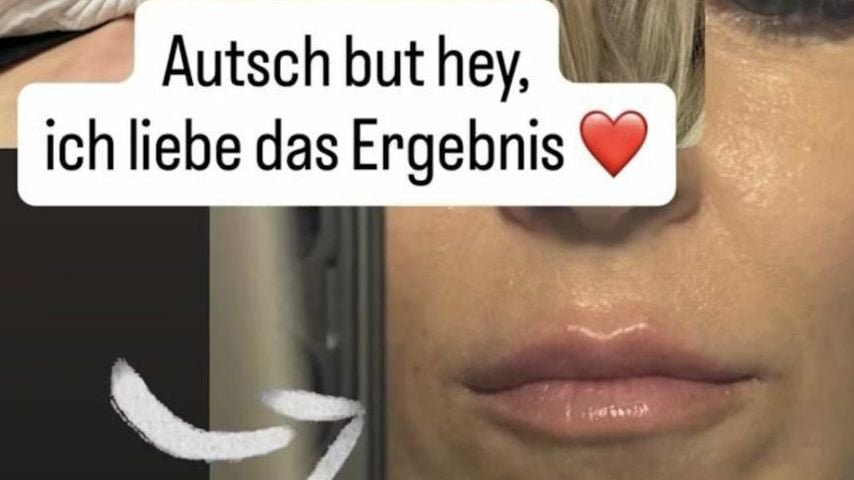 Simone Lugner nach Beauty-Eingriff, März 2026