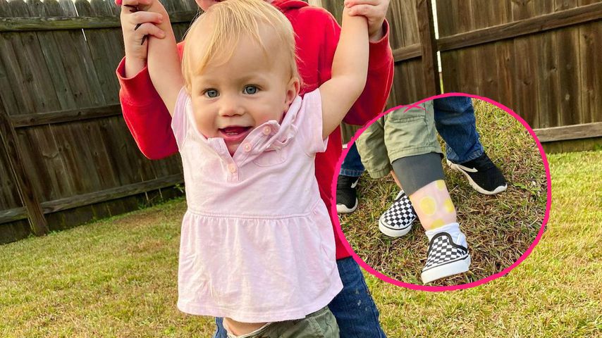 "Sister Wives"-Maddies Tochter (1) zeigt ihre Bein-Prothese!