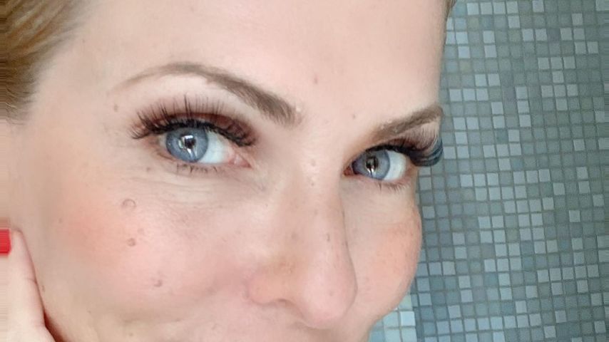 Folgen der Chemo: Sonya Kraus hat eine Glatze am Hinterkopf