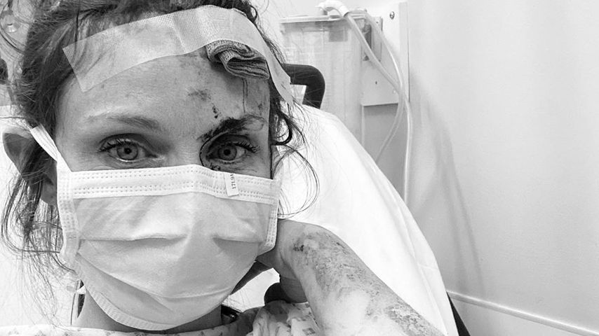 Blutiges Bild: Sophie Ellis-Bextor nach Unfall in der Klinik