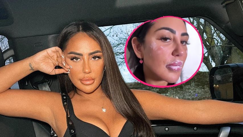 Sophie Kasaei zeigt sich nach ihrer Tränensackbehandlung