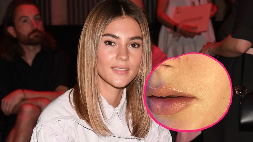 Damenbart – und wenn schon? Stefanie Giesinger steht dazu!