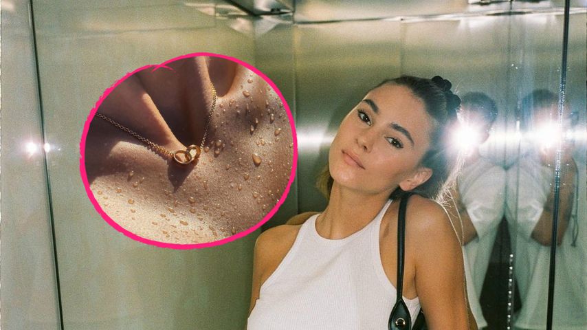 Ketten-Hinweis: Hat sich Stefanie Giesinger etwa verlobt?