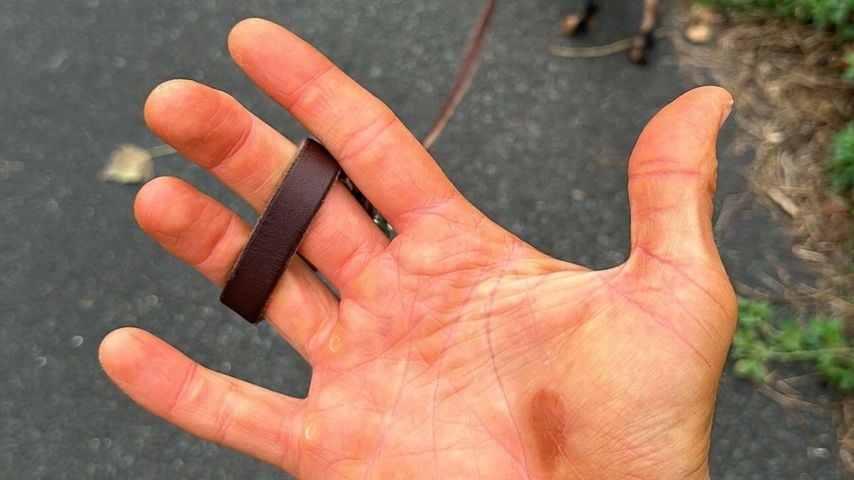 Stefano Zarrella hat Selbstbräunerflecken auf der Hand