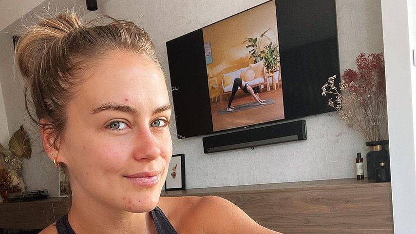 Schwangere Steph Claire Smith hat mit Pickeln zu kämpfen