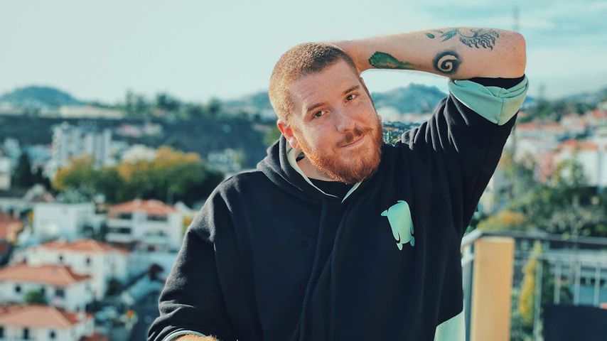 Gesicht geschwollen: Deshalb war YouTube-Unge im Krankenhaus