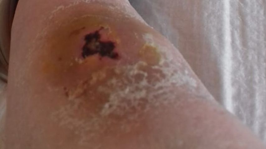 Schwiegertochter-Ingo gibt OP-Update: So geht es Mama Stups!