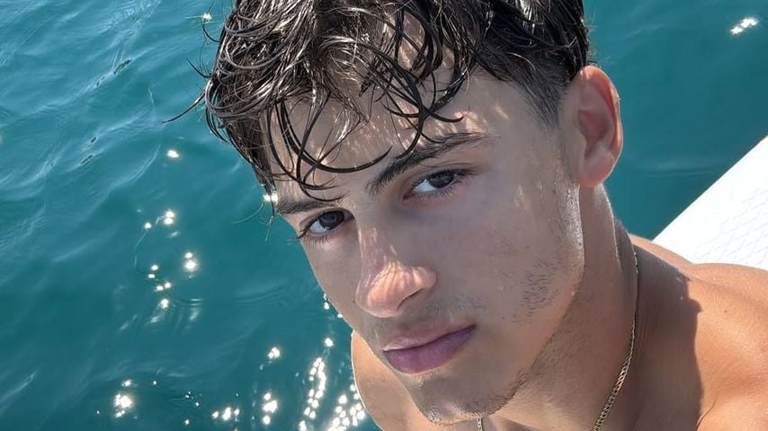 "Survivor Griechenland": Kandidat verliert Teil seines Beins