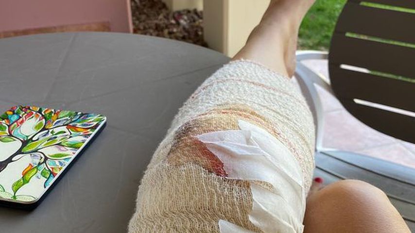 Susan Sideropoulos nach ihrem Fahrrad-Unfall im Juli 2021