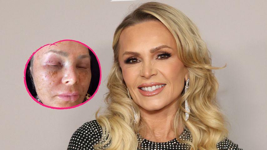 Nach Schönheits-OP: Tamra Judge ist kaum wiederzuerkennen